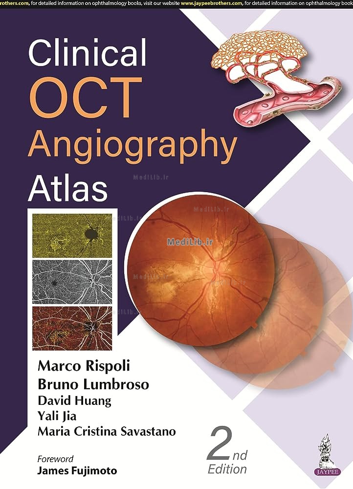 Clinical OCT Angiography Atlas