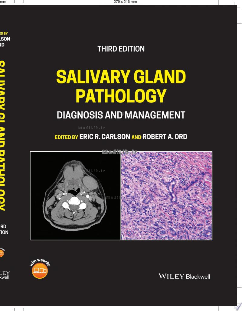 Salivary Gland Pathology