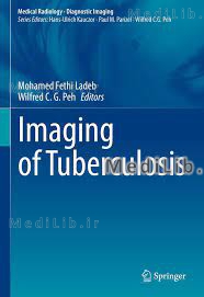 Imaging of Tuberculosis