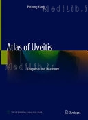 Atlas of Uveitis