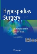 Hypospadias Surgery