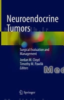 Neuroendocrine Tumors