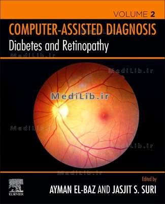 Diabetes and Retinopathy