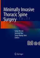 Minimally Invasive Thoracic Spine Surgery