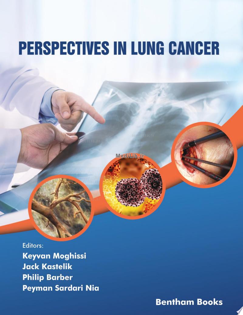 Perspectives in Lung Cancer