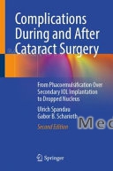 Complications During and After Cataract Surgery