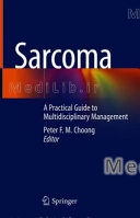 Sarcoma