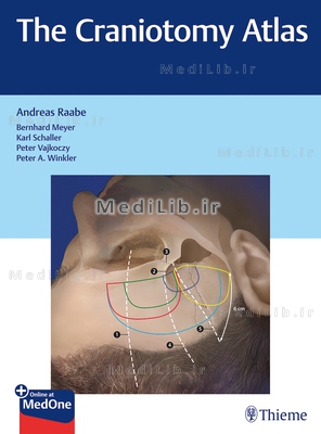 The Craniotomy Atlas