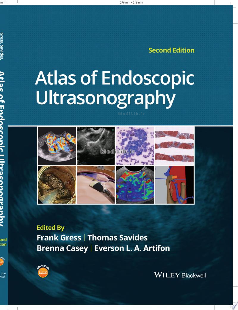 Atlas of Endoscopic Ultrasonography