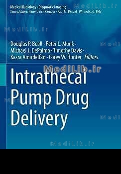 Intrathecal Pump Drug Delivery