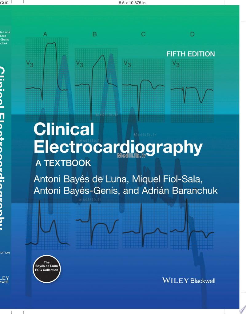 Clinical Electrocardiography