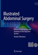 Illustrated Abdominal Surgery