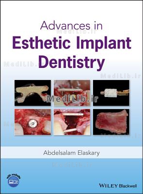 Advances in Esthetic Implant Dentistry