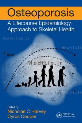 Osteoporosis: A Lifecourse Epidemiology Approach to Skeletal Health