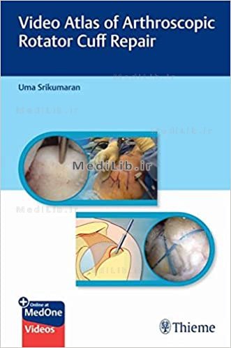 Video Atlas of Arthroscopic Rotator Cuff Repair