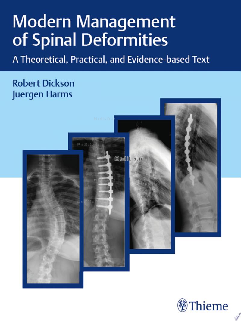 Modern Management of Spinal Deformities