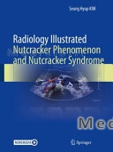 Radiology Illustrated: Nutcracker Phenomenon and Nutcracker Syndrome