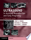 Ultrasound in Assisted Reproduction and Early Pregnancy