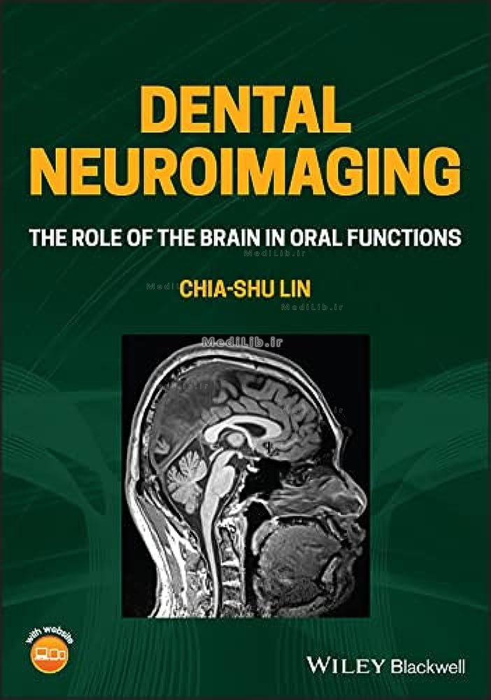 Dental Neuroimaging