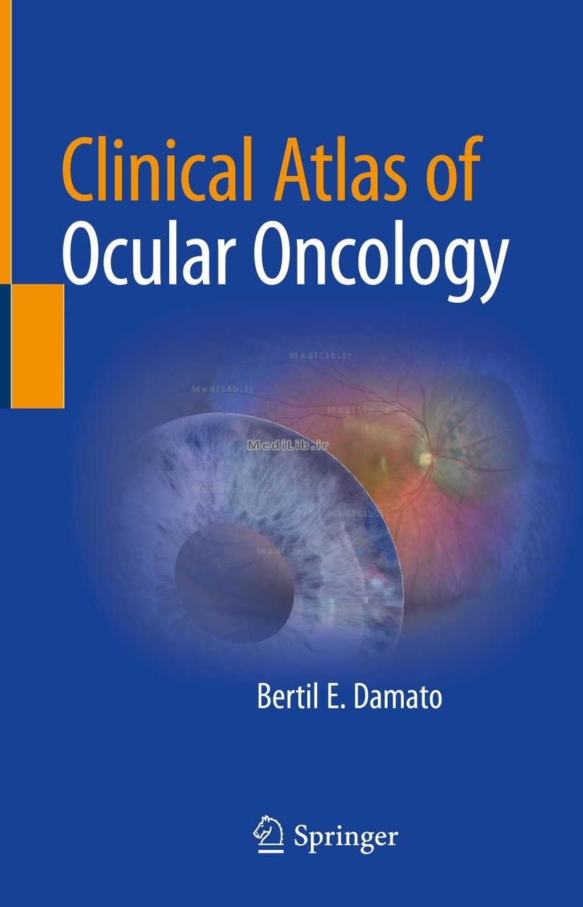 Clinical Atlas of Ocular Oncology