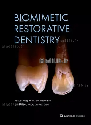 Biomimetic Restorative Dentistry