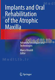 Implants and Oral Rehabilitation of the Atrophic Maxilla