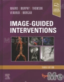 Image-Guided Interventions