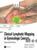 Clinical Lymphatic Mapping in Gynecologic Cancers