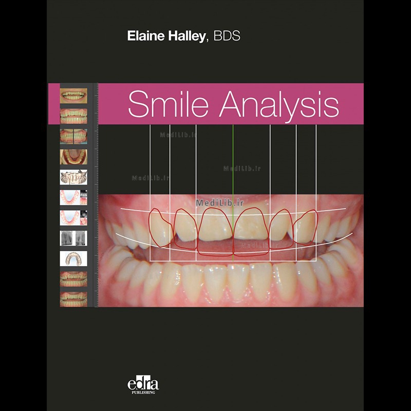 Smile Analysis