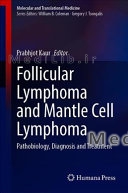 Follicular Lymphoma and Mantle Cell Lymphoma