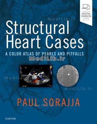 Structural Heart Cases: A Color Atlas of Pearls and Pitfalls