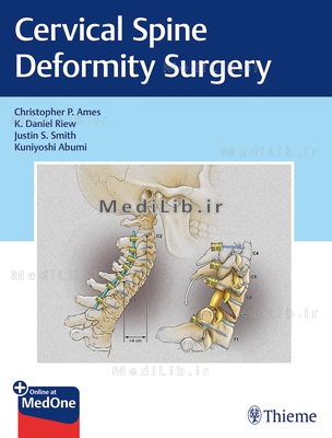 Cervical Spine Deformity Surgery