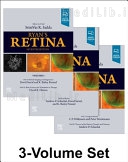 Ryan's Retina