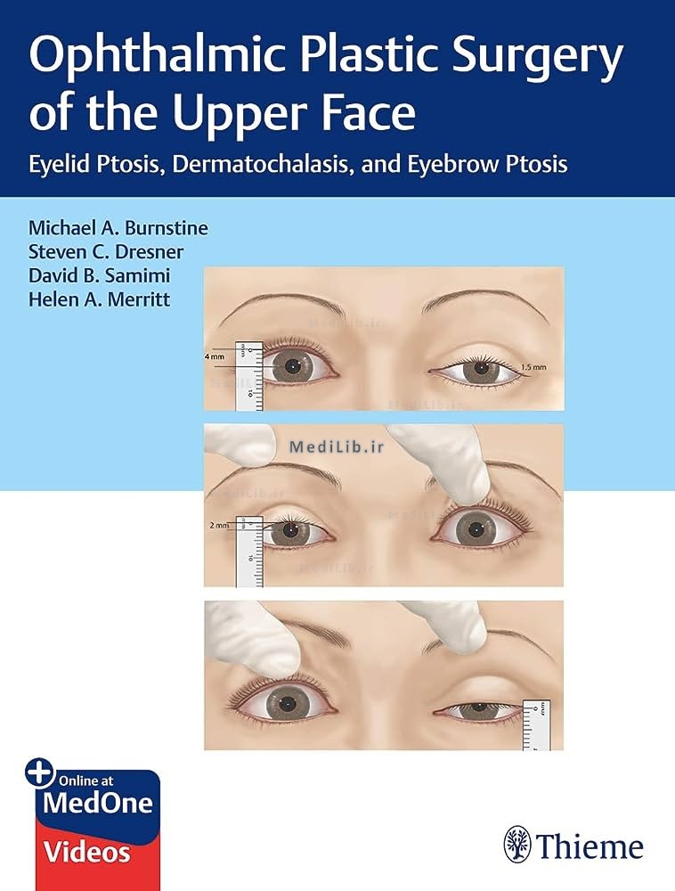 Ophthalmic Plastic Surgery of the Upper Face: Eyelid Ptosis, Dermatochalasis, and Eyebrow Ptosis