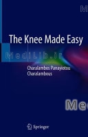 The Knee Made Easy