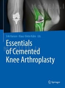 Essentials of Cemented Knee Arthroplasty