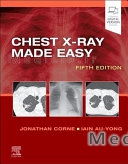 Chest X-Ray Made Easy