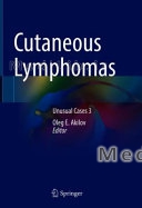 Cutaneous Lymphomas