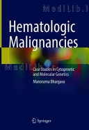 Hematologic Malignancies