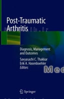 Post-Traumatic Arthritis