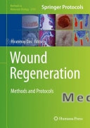 Wound Regeneration