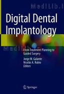 Digital Dental Implantology