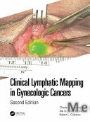 Clinical Lymphatic Mapping in Gynecologic Cancers