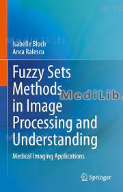 Fuzzy Sets Methods in Image Processing and Understanding