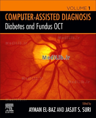 Diabetes and Fundus OCT