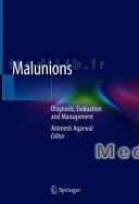 Malunions